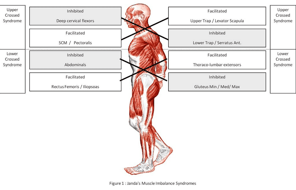 dynamic neuromuscular stabilization upper and lower cross syndrome 